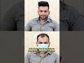 Hair Patch Clip System| Hair Patch Service