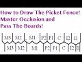 Occlusion  picket fence  nbde part 1 boards study