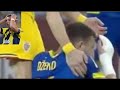 Edin Dzeko injury | Fenerbahce’s striker Dzeko breaks nose during national game