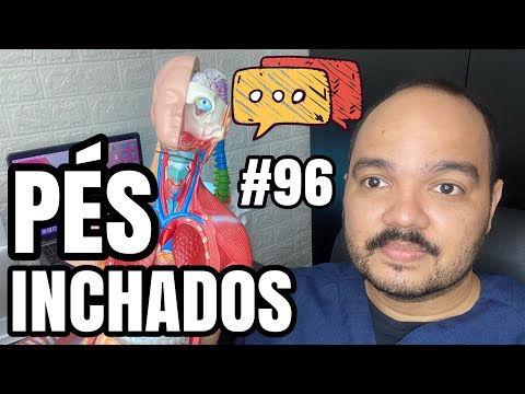 PÉS INCHADOS (EDEMA): causas e tratamentos de inchaço nos pés e pernas. #comentários