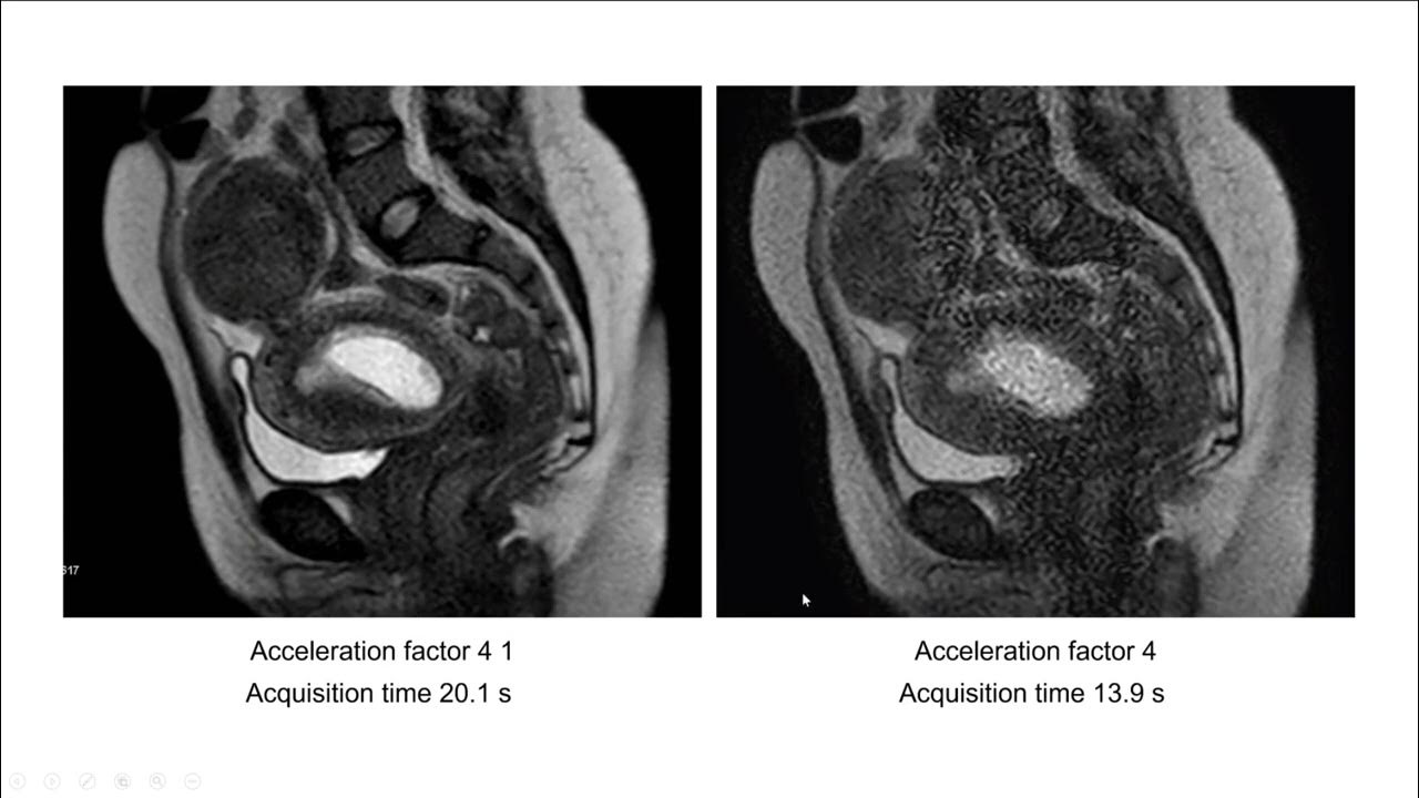 Abdominal MRI Practical Applications and Advanced Imaging Techniques