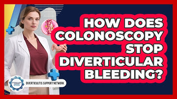How Does Colonoscopy Stop Diverticular Bleeding? - Diverticulitis Support Network
