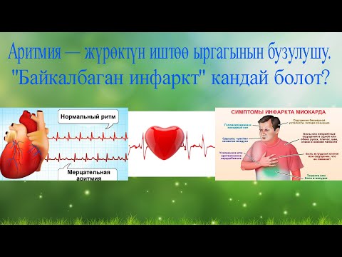 Video: Инсультка көбүнчө жүрөктүн себеби эмнеде?