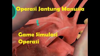 Operasi Jantung Game Simulasi -- Operate Now : Hospital screenshot 2