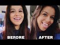 GETTING MY BRACES OFF!!! | VLOG