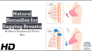 Sagging Breasts No More: Natural Ways to Achieve Firmer Skin