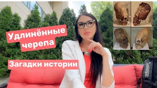 Удлиненные черепа и другие загадки истории! #загадкиистории