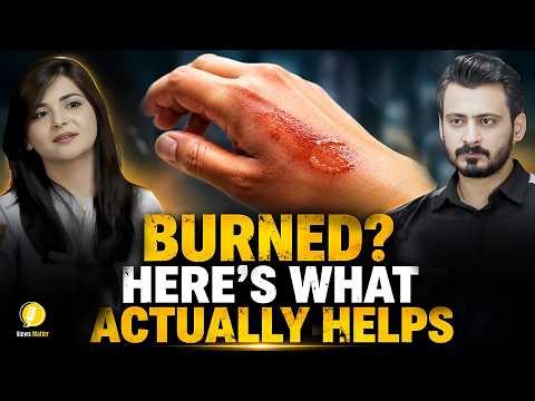 Burned? Here’s What Actually Helps | Dr. Kanza Aftab Explains Burn First Aid | Views Matter Podcast