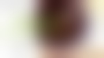 Simplifying Hard Cataract Phaco for 