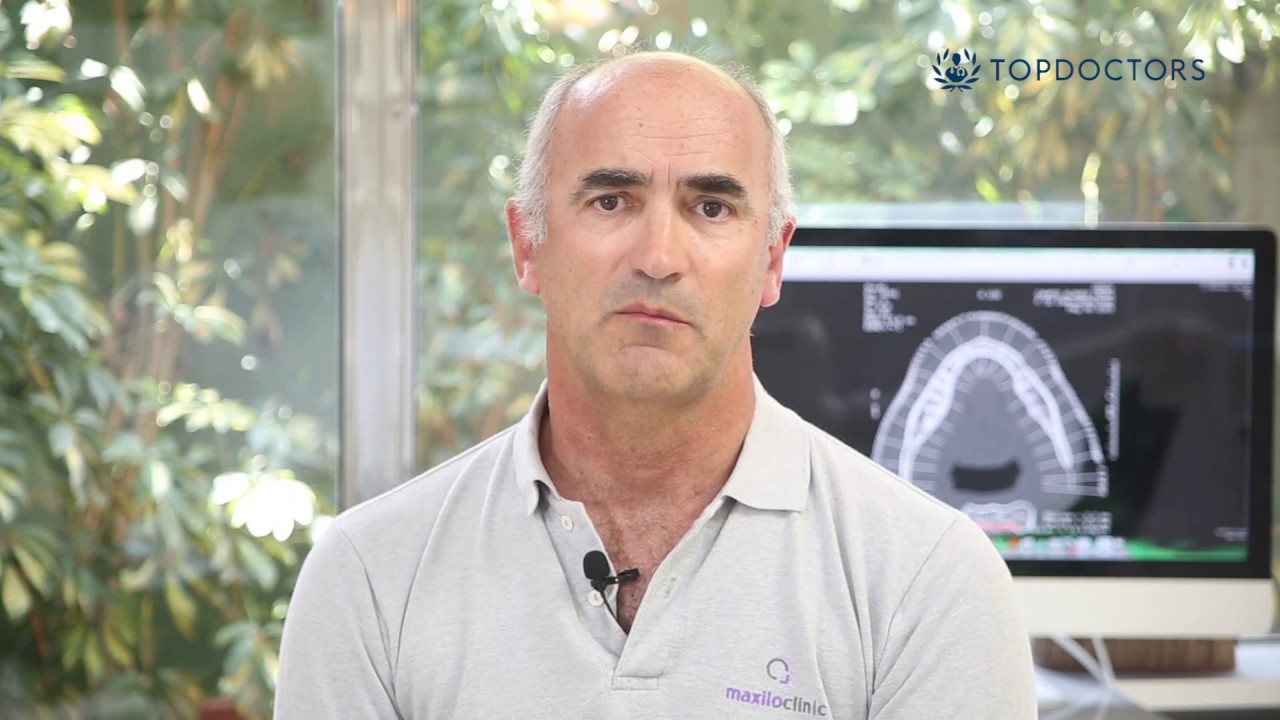 ¿Los implantes dentales son para toda la vida? top movies on netflix