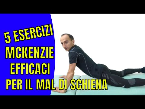 Video: Esercizi McKenzie: Esercizi Da Provare Per Lombalgia, Sciatica