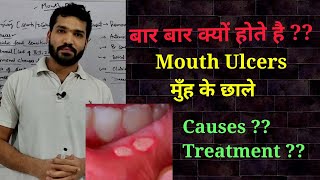Mouth ulcers, Causes & Treatment?? Causes of mouth ulcers?