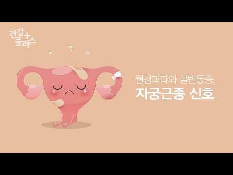 자궁근종 [건강플러스]