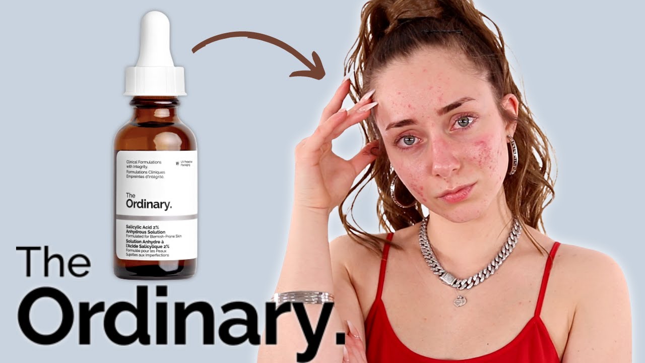 The Ordinary Salicylic 2% Anhydrous Solution Review - Does It Work For  Blemish prone skin? - YouTube