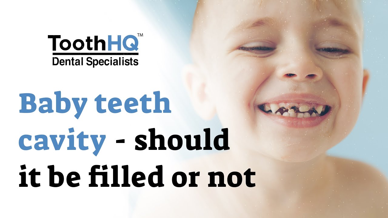 Baby Teeth CavityShould It Be Filled or Not? Dr. Kumar T. Vadivel, DDS