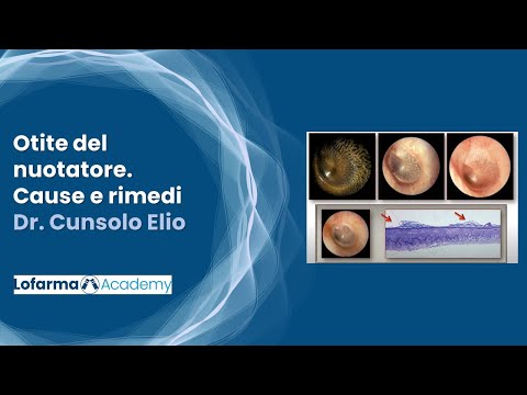 Video: Quando scompare l'orecchio del nuotatore?