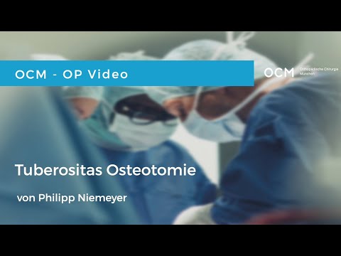 OCM Operationsvideo | Für Ärzte | Transfer der Tuberositas Tibiae