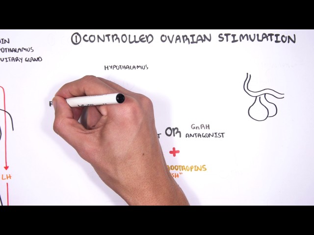 In Vitro Fertilization (IVF) - Overview class=