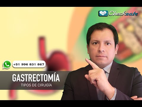 Vídeo: Gastrectomía: Propósito, Procedimiento Y Tipos