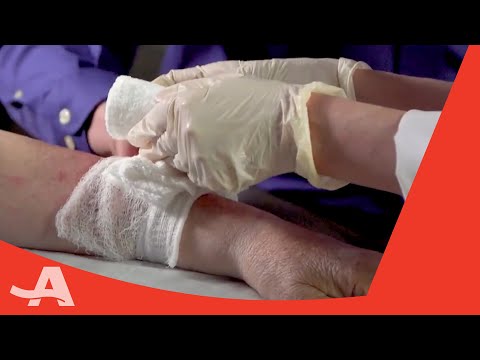 Video: 4 måder at helbrede et hudtår på