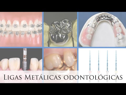 Vídeo: Quais são os três metais nobres usados em odontologia?