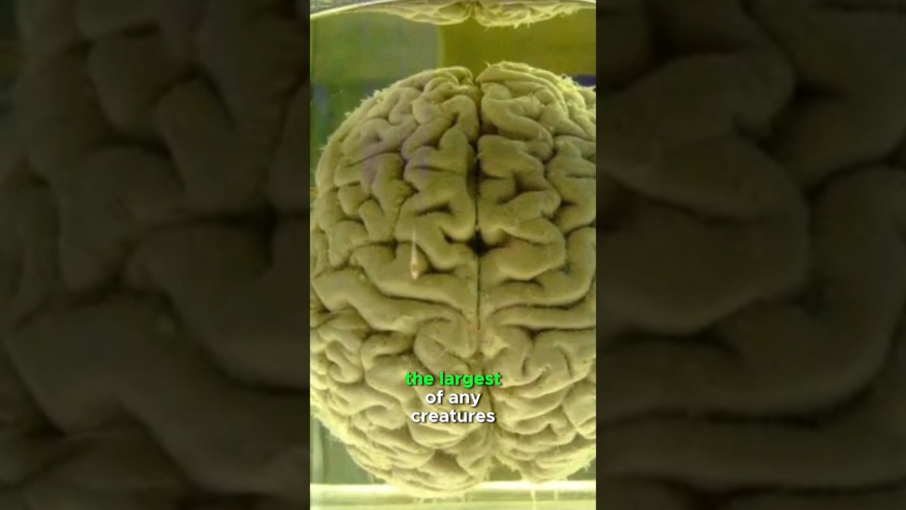 The world's largest brain😯 