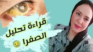 قراءة تحليل الصفرا الكلية والمباشرة وارتفاعها