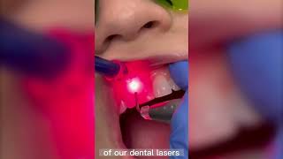 How A Dental Laser Can Benefit You