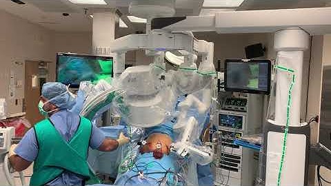 Intra Operative Cholangiogram for Robot-Assisted Cholecystectomy- Xi Docking from the Patients Left