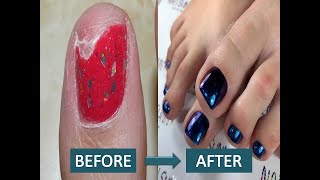 Most Satisfying Pedicure and Ingrown Nail Treatment