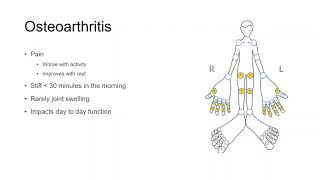 Ask the Rheumatologist: Is There a Cure for Osteoarthritis?