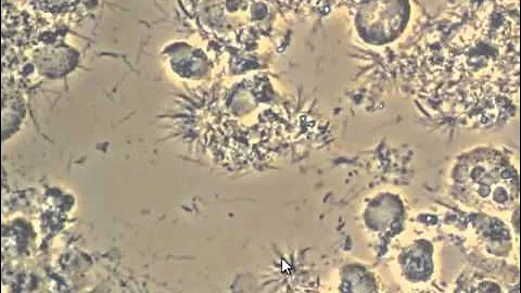 How Spirochetes colonize and cause gum disease in your mouth