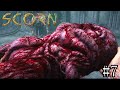【SCORN】 血みどろベイベー part7