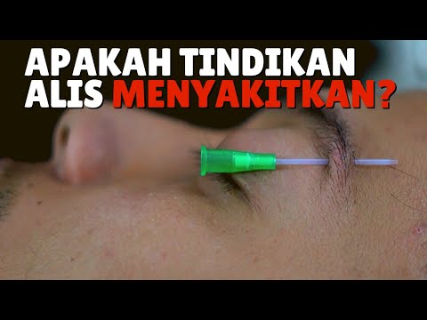 Video: Adakah menindik auricle menyakitkan?