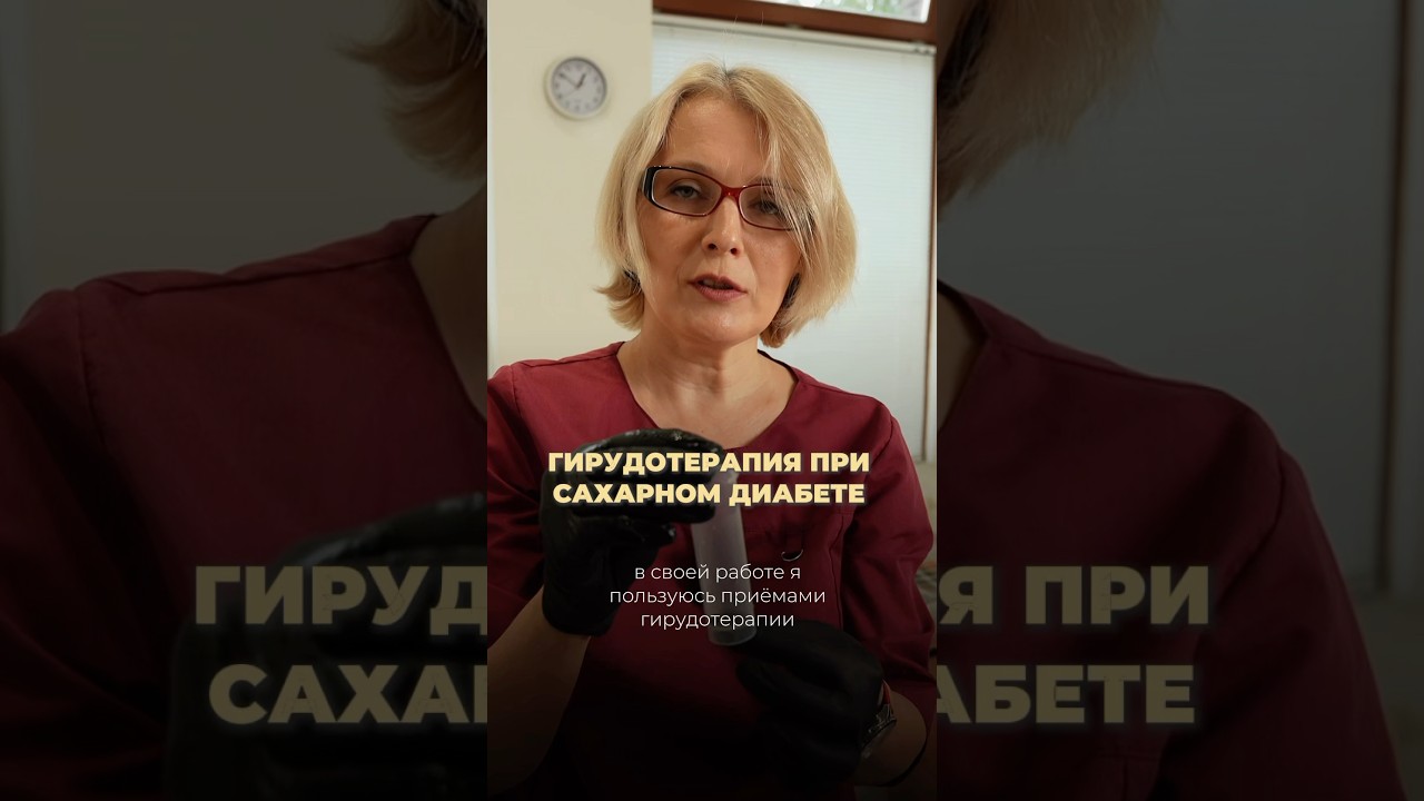Гирудотерапия при сахарном диабете #здоровьечеловека #tens #пиявки #сахарныйдиабет #лечение #клиника
