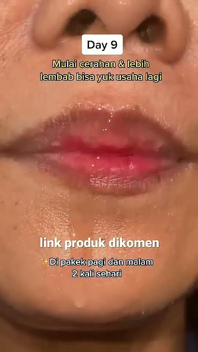 BIKIN BIBIR HITAM JADI PINK LAGI #shorts