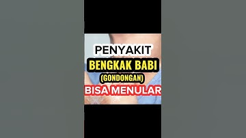 Penyakit bengkak babi (gondongan) bisa menular #funnyshorts #shorts #hidupsehat