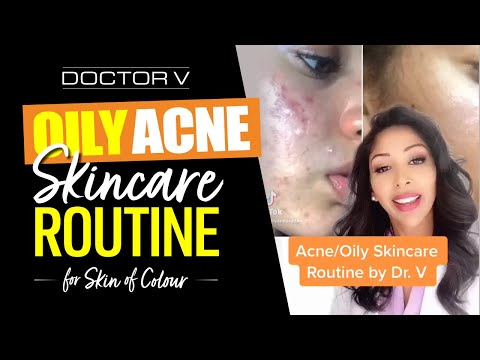Doctor V - Oily, Acne Skincare Routine For Skin of Colour | Brown Or Black Skin | #shorts
