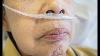 National ARC webinar: Breathlessness in palliative and end of life care research,  2 December 2024