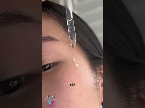 لماذا ي عد ألفا أربوتين من   الحل السحري لتفتيح البشرة