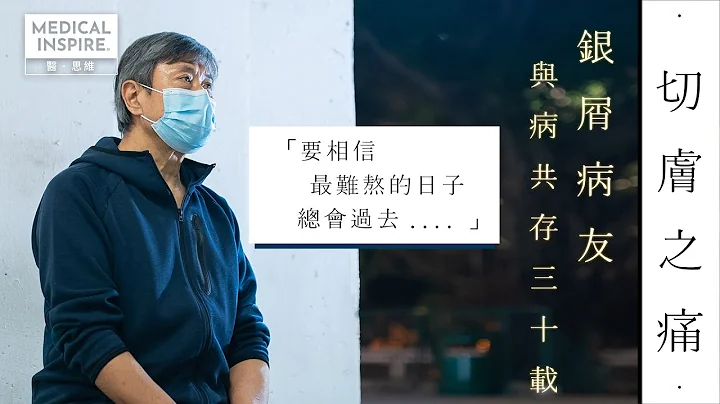 切膚之痛——銀屑病友與病共存三十載 「要相信最難熬的日子總會過去」 - 天天要聞