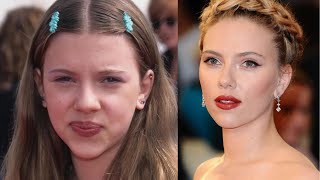 From Natural to Glam: 5 Actresses Who Changed Their Looks with Surgery!