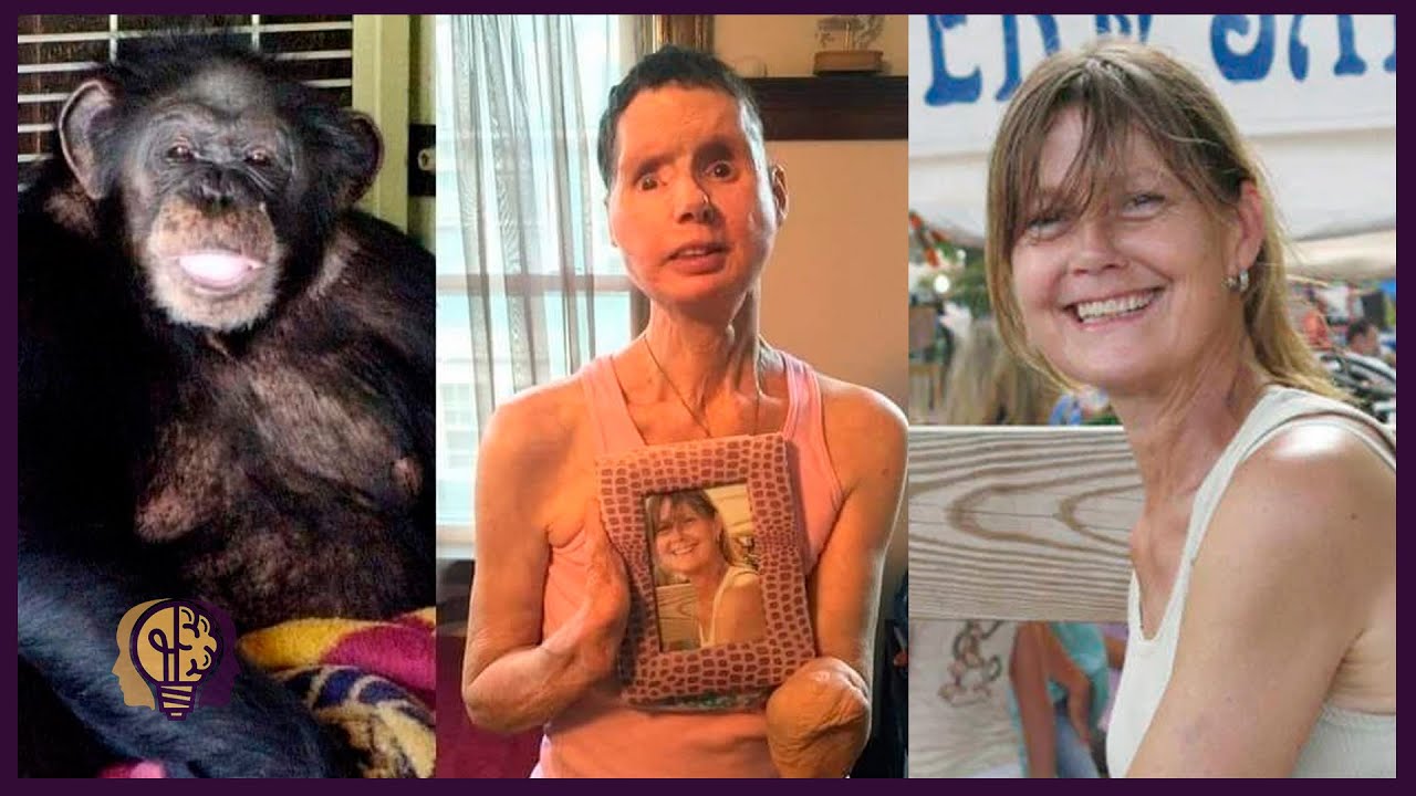 Charla Nash Chimpanzé Ataca Amiga da Dona YouTube Charla Nash Chimpanzé Ataca Amiga da Dona YouTube