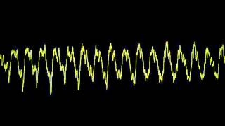 Station (the secret of young love) - Secretions Of Yore