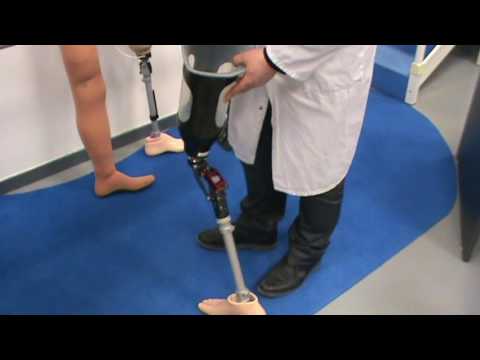 Vidéo: Combien coûte une prothèse de membre I ?