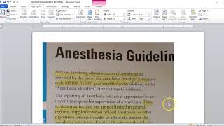 Anesthesia part 2