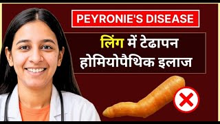 लग म टढपन ,करण,हमयपथक इलज Ling Me Tedapan Peyronies Disease Treatment