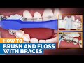 How to Brush & Floss with Braces