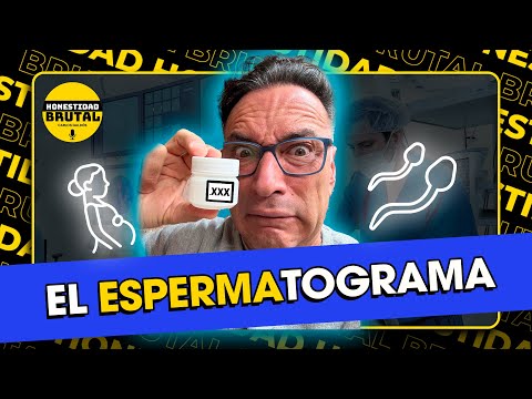EL ESPERMATOGRAMA CON CARLOS GALDÓS EN