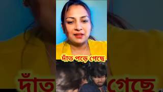 দাঁতালের দাঁত ফেলে দিছে #funny #nilaisrafil #ytshorts #news #politcs